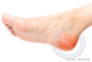 伤口包扎用什么包扎好得快,伤口包扎一般自己怎么处理