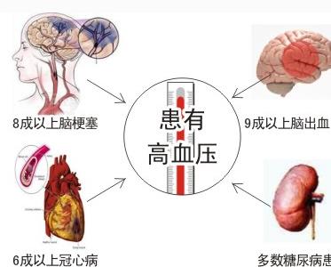 血压高血糖高的治法,一招治高血压高血脂高血糖