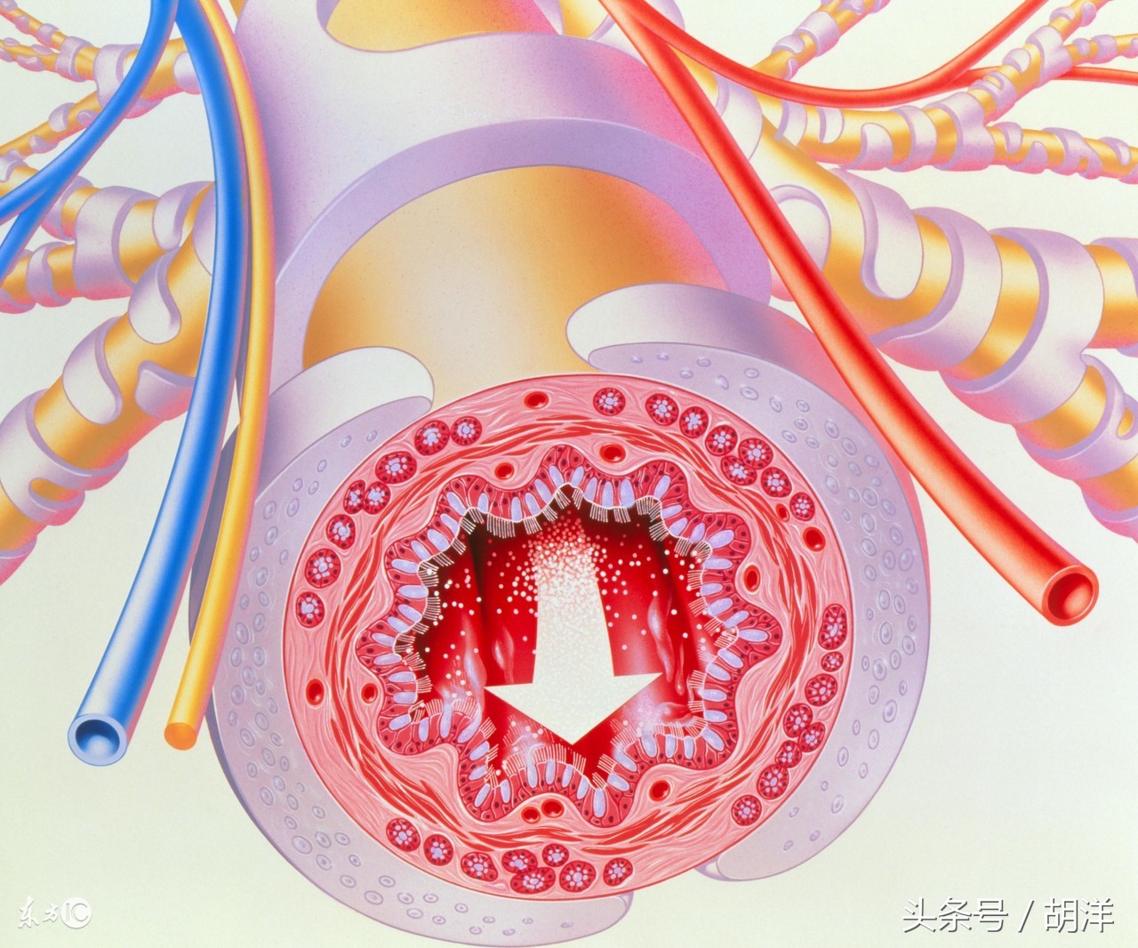 支气管扩张治愈后能喝酒吗,支气管扩张肺气肿能不能治愈