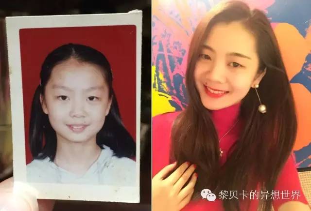 她们说||那些年整牙吞下的血和泪,终于换来最开怀的大笑