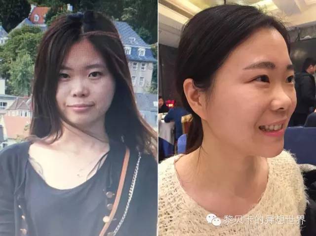 她们说||那些年整牙吞下的血和泪,终于换来最开怀的大笑