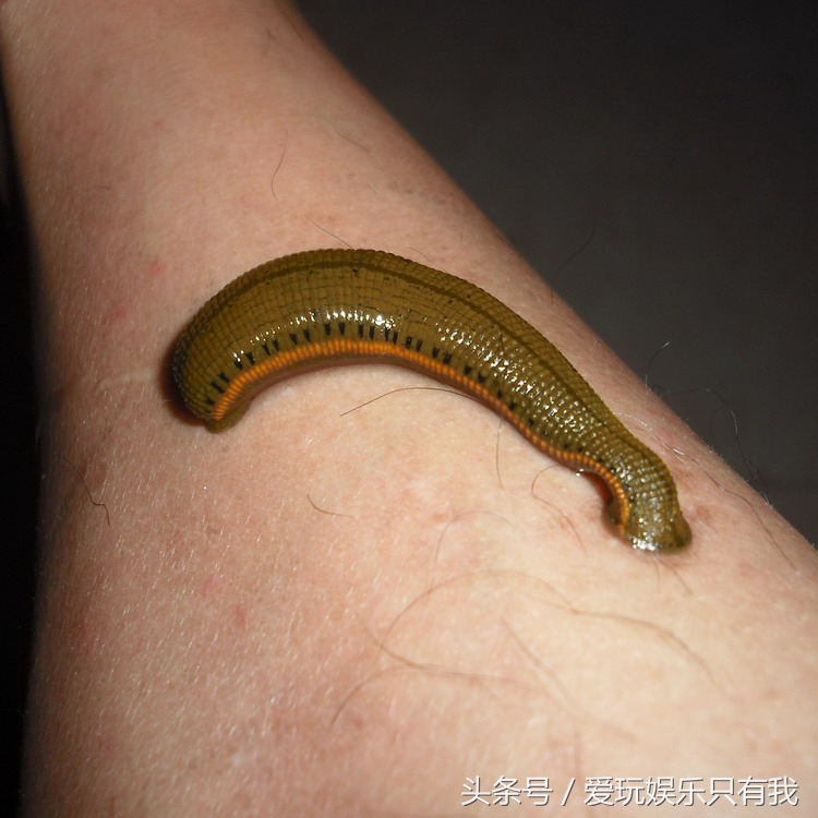 野外被蚂蟥咬了怎么处理,在户外被蚂蟥叮了怎么办