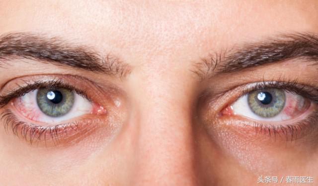 眼睛里面有刺痛感痒怎么回事,小朋友眼睛痒痒总是揉是怎么回事