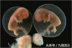 反复做人流对女性有哪些危害,女的做人流有什么不好