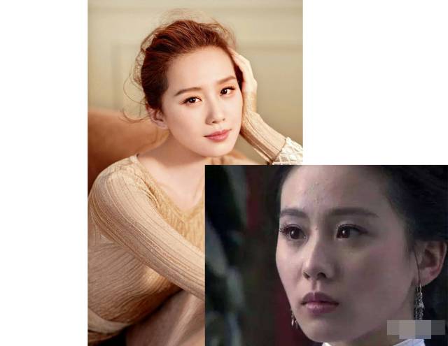 粉刺黑头去除最快方法,黑头虫怎么去除最快方法