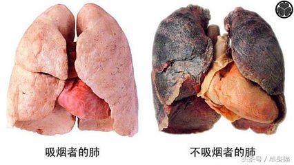 吸烟对肝危害大吗,吸烟有什么危害