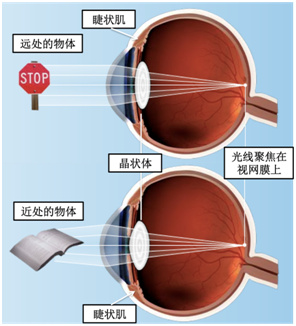 为什么配眼镜要散瞳验光,为什么配眼镜要试镜