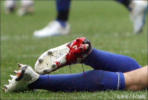 足球场上十大惨烈瞬间,足球场受伤瞬间图片