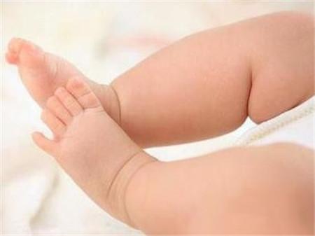 新生儿腿不直是怎么回事,新生儿腿不长肉怎么回事