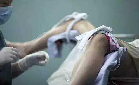 脑积水宝宝最明显表现,六个月宝宝脑积水症状