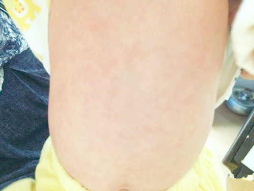 家长说孩子身上有痱子,奶奶一直认为宝宝什么都不知道