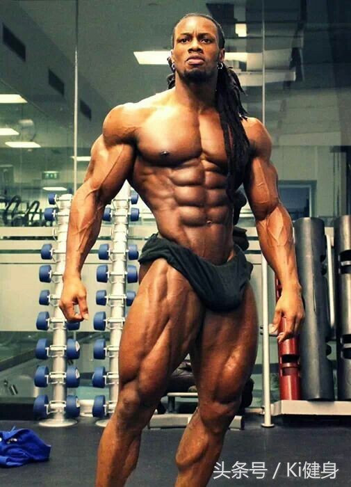 腹直肌上部分离,产后腹直肌分离