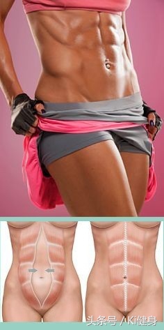 腹直肌上部分离,腹直肌及腹直肌分离