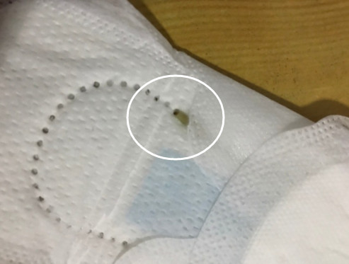 卫生巾要不要经常换,如果卫生巾过了很久没换会怎么样