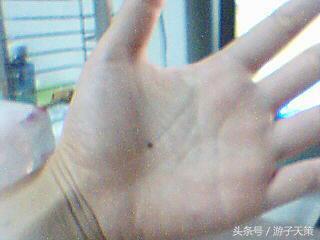 女人肚子十大福痣,耳朵有痣十大福痣