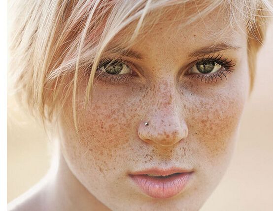 怎样区分自己脸上的斑是什么斑,怎样分辨脸上的斑是什么斑