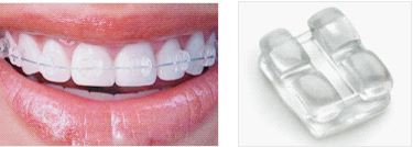 少了一颗牙齿戴牙套矫正全过程,不用牙套能不能把龅牙搞回去