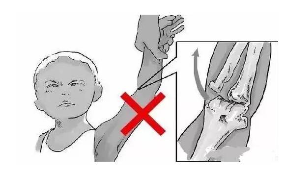 小孩避免罗圈腿坐姿,宝宝怎么坐姿不会驼背