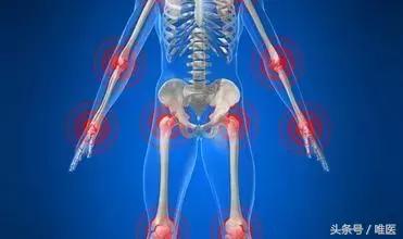 容易误诊成股骨头坏死的疾病,磁共振股骨头坏死有没有可能误诊