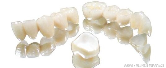 几百元一颗牙齿,几百一颗的牙贴面好吗