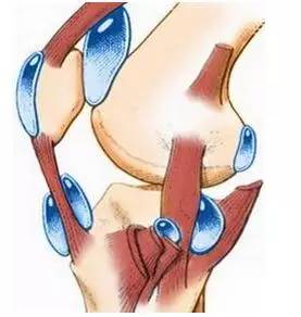 有一种关节肿，叫做滑膜炎