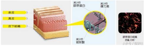 医美联合治疗拒绝“阿婆”面相