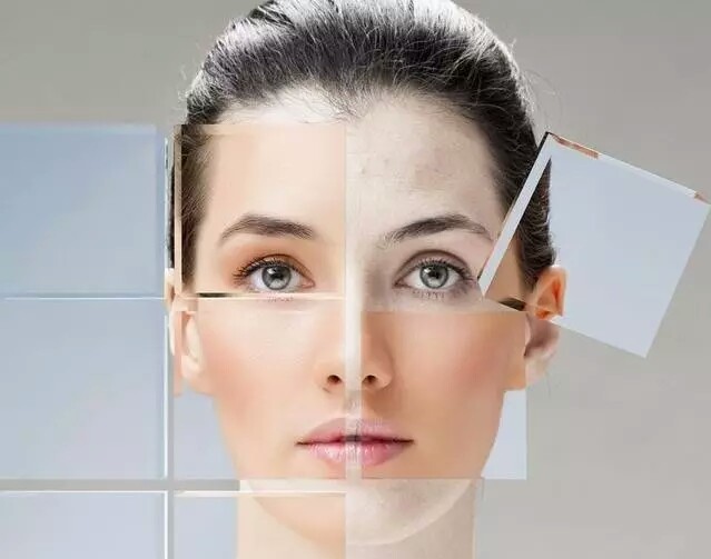 脸t区敏感怎么护理,脸部t区黄最快最简单的方法