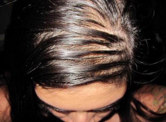 头发油腻怎么办,头发油腻吃什么东西改善