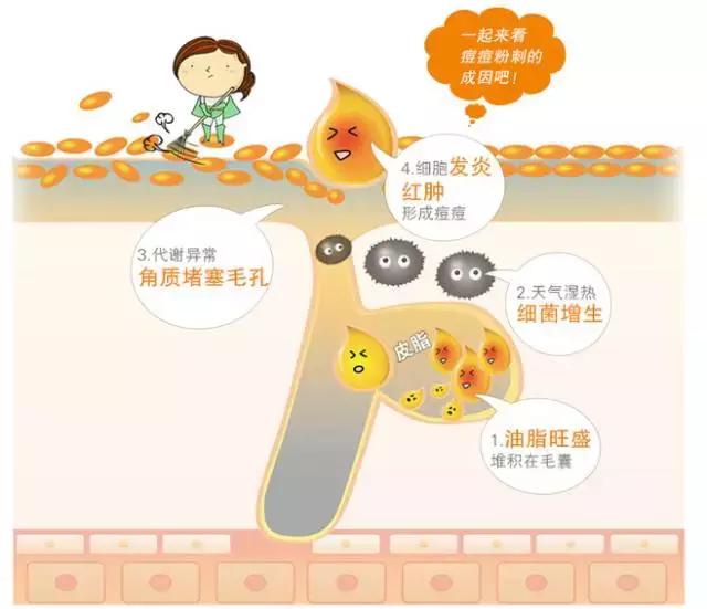 祛痘痘的正确护肤方法,长痘祛痘用什么方法最有效