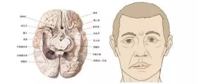 有专治半边瘫的医院吗,全国治半边瘫排名第一的医院