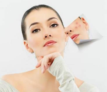 淑女说：今天，你打“痘痘”了吗？