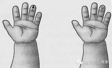 过敏性鼻炎咳嗽推拿哪些穴位,过敏性咳嗽变异性哮喘推拿