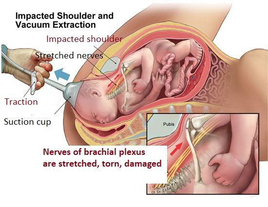 儿童肥胖将直接影响成年后的健康,儿童肥胖怎么办?