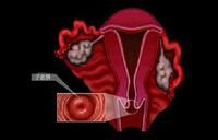 女性妇科疾病和哪个脏器有关,女性的妇科疾病大多是男性造成的