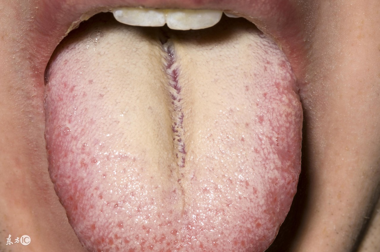 舌苔白又厚可以用盐水除掉吗,舌苔白用什么生姜