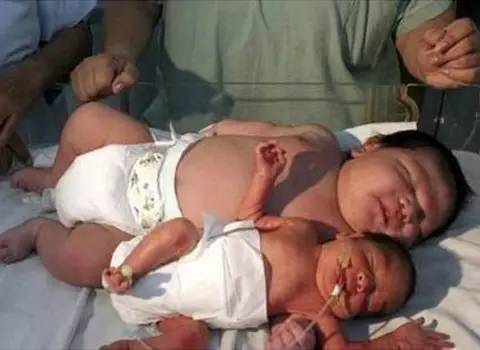 孕期要怎么做才不长妊娠纹,孕期如何做有利于生产