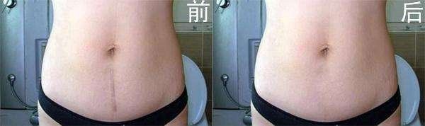 深扒那些爆火的网红减肥法,深扒8种抗衰老成分