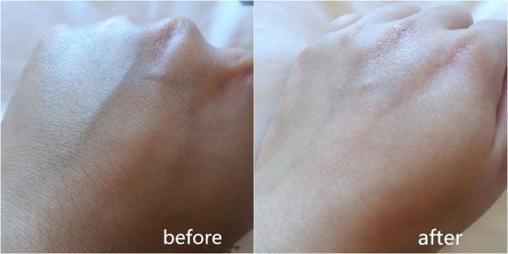 深扒“网红”神油,8周改善妊娠纹和疤痕~