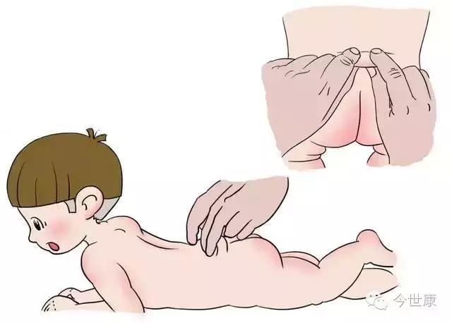 孩子捏脊功效,小孩捏脊百病消