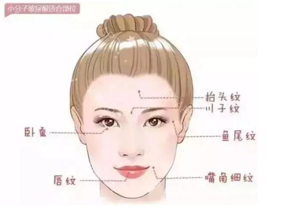 真正的玻尿酸是什么样子的呀,玻尿酸到底是个什么东西啊