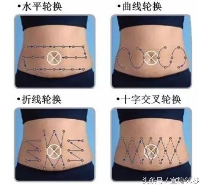 全球最细的胰岛素注射针头,8mm长的胰岛素注射针头适合哪种人