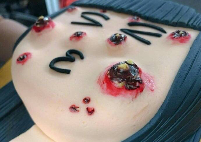 怎样可以预防痘痘和祛痘痘,非常大的痘痘怎么根除原因是什么