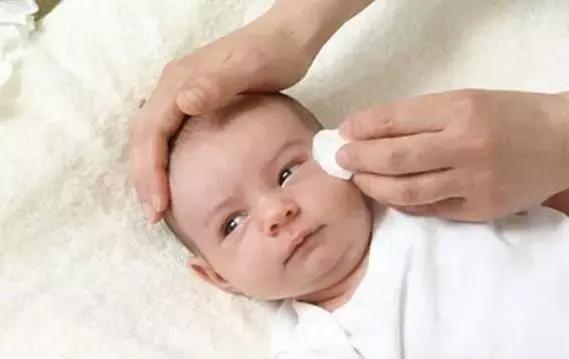 新生宝宝眼睛被眼屎粘住怎么清理,新生儿眼屎糊住眼睛怎么清洁