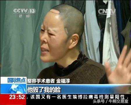 韩国割双眼皮要多少钱人民币,韩国割双眼皮多少钱人民币