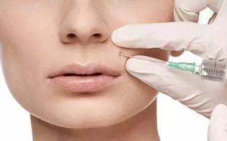 微整形一般几天消肿,微整形需要多久才能学