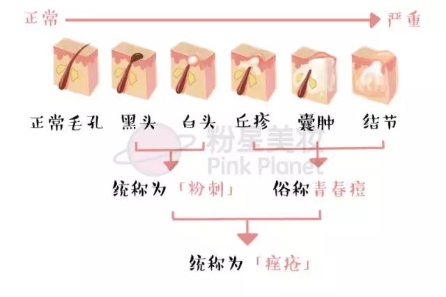 脸上痘痘好不了中药可以祛痘痘吗,女人面部额头长痘祛痘护理指南