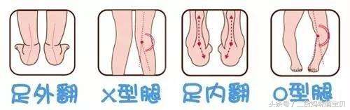 万万想不到的鞋子,孩子长期穿这样的鞋子要当心了