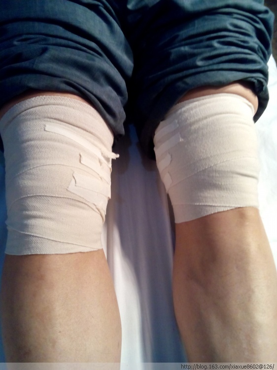 这疾病中老年人几乎人人有,本无大碍,但很多人因不重视进了医院