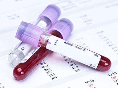 护士一分钟看懂血常规检验报告,教你三分钟看懂血常规报告卡通版