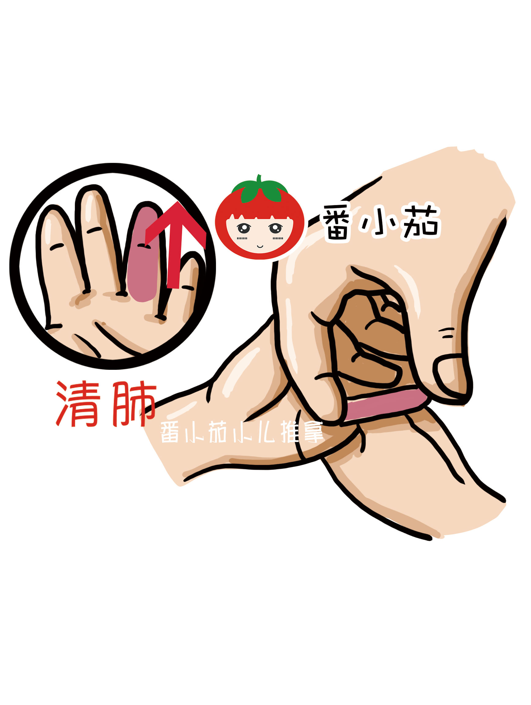 过敏性咳嗽——调理体质是关键